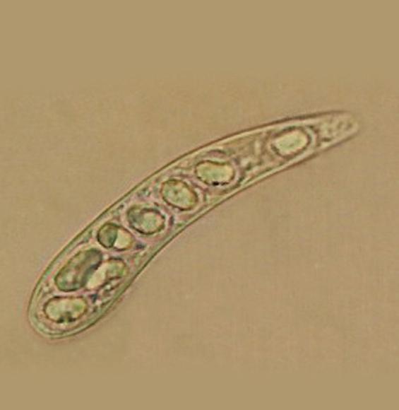 Chloroscypha chamaecyparidis (Sawada) Kobayashi 이미지