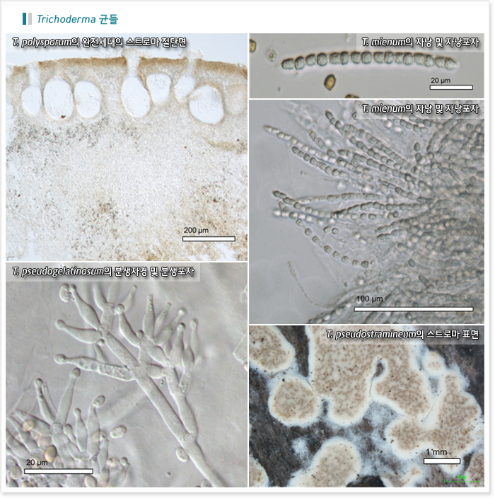 Trichoderma균들/ T. polysporum의 완전세대의 스트로마 절단면, T. mienum의 자낭 및 자낭포자1, T. mienum의 자낭 및 자낭포자2, T. pseudogelatinosum의 분생자경 및 분생포자   ,T. pseudostramineum의 스트로마 표면 